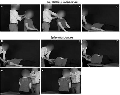 Positional Manoeuvres for BPPV: Theoretical Approach to Remote Training for Non-specialists